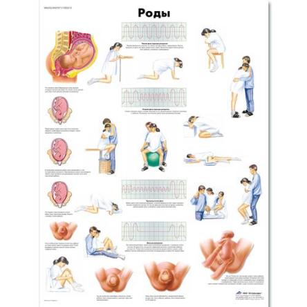 Купить Медицинский плакат "Роды"