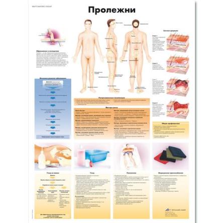 Купить Медицинский плакат "Пролежни"